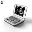 B/W Ultrasound